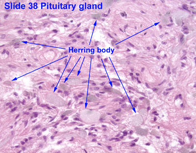 Herring bodies Wikipedia
